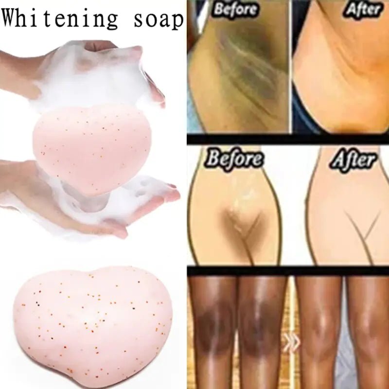 Lightening Soap: Body Care Solution - Kaiju Mafia